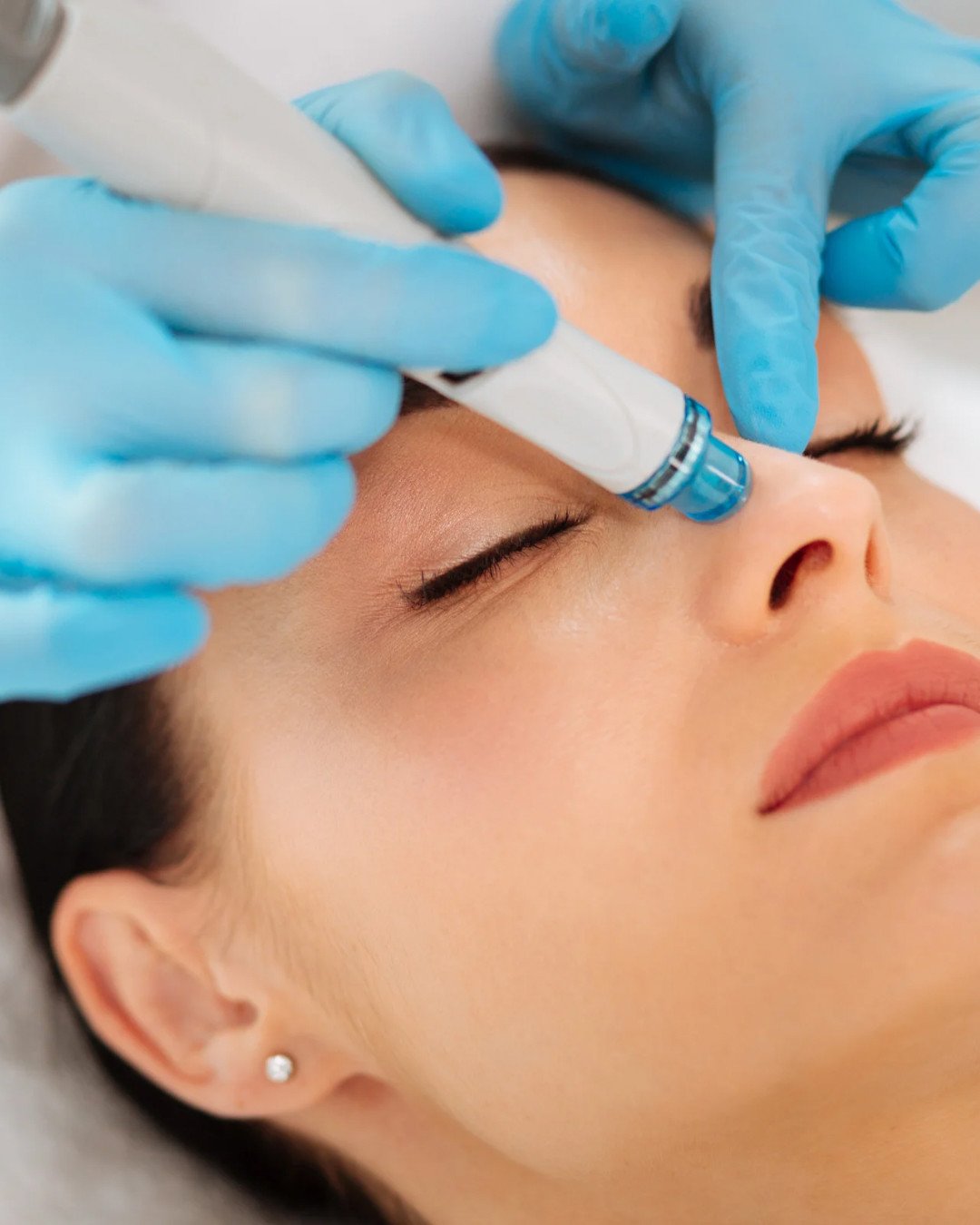 Hydrafacial