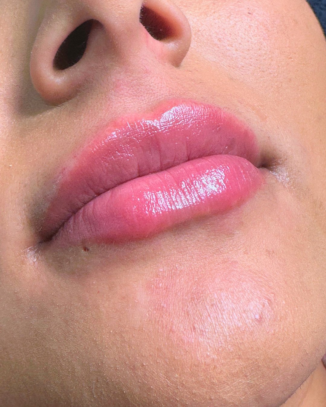 Filler